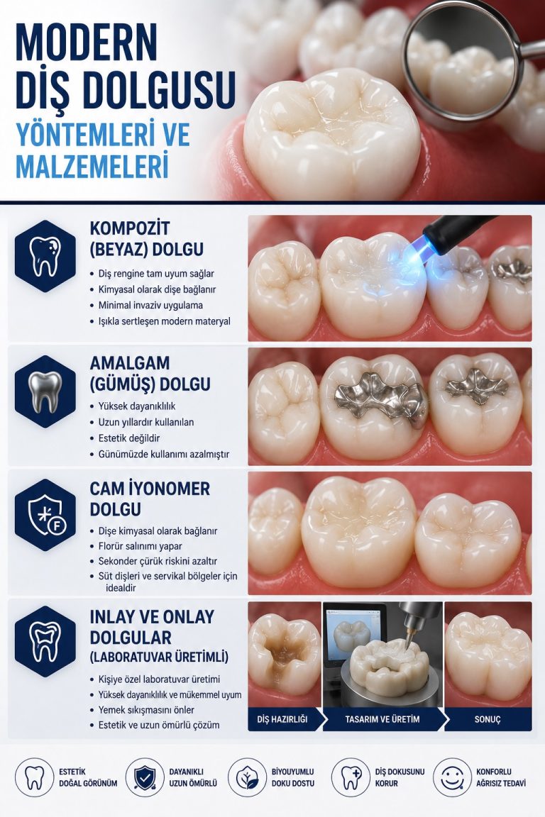 Diş Dolgusu3 Modern Diş Dolgusu Yöntemleri ve Malzemeleri