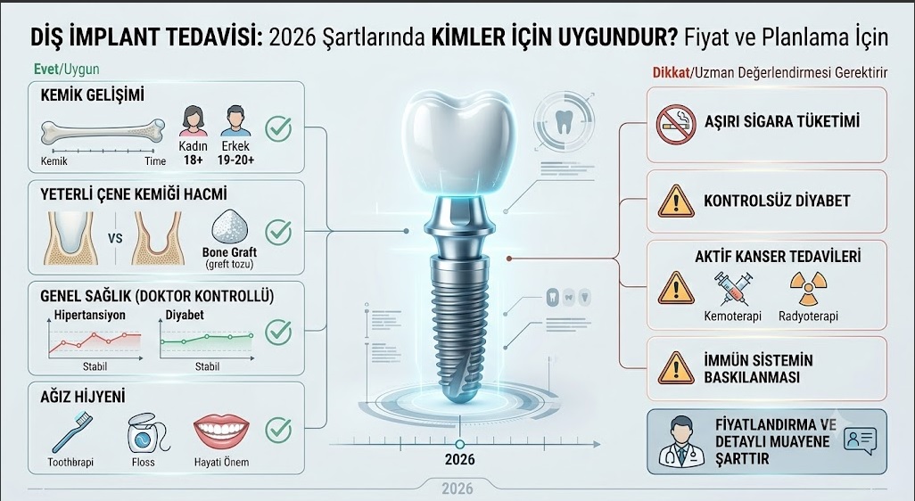 Diş İmplant Fiyatları 2026 Şartlarında Tedavi Kimler İçin Uygundur?