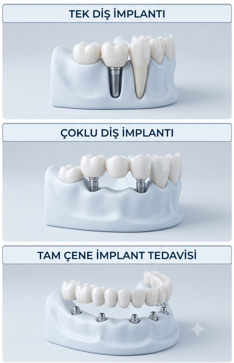 https://akdisklinigi.com/wp-content/uploads/2026/07/Implant6-768x1189.jpg