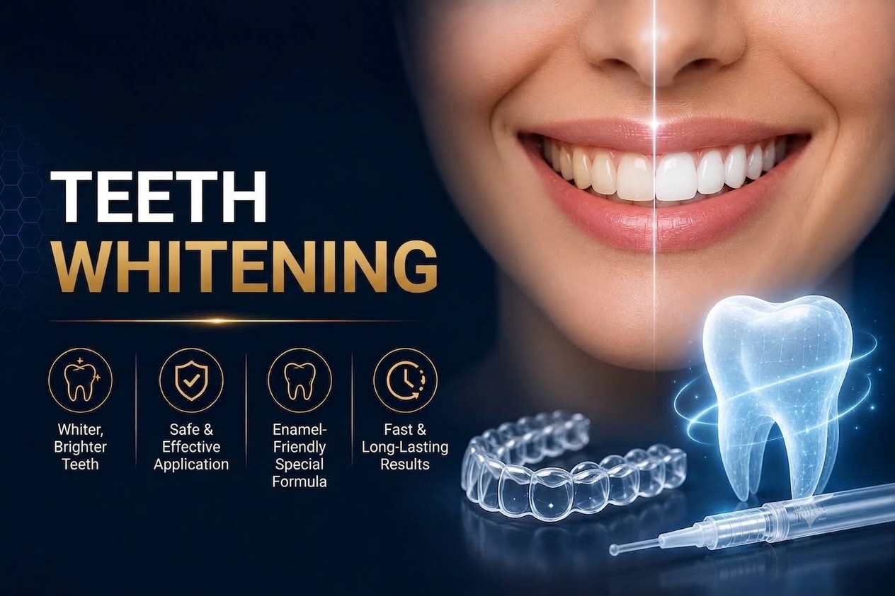 Temporary tooth sensitivity after professional teeth whitening