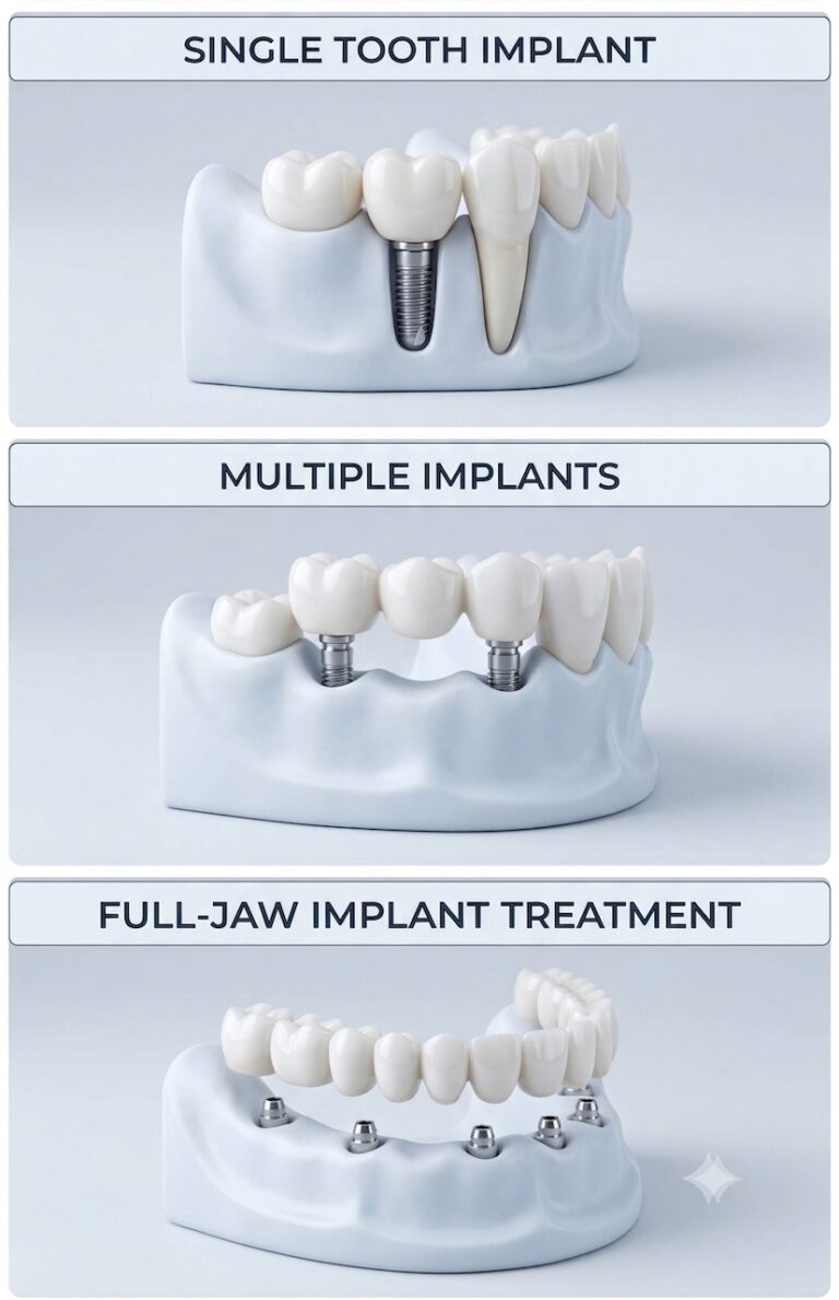 Implant6-EN https://akdisklinigi.com/wp-content/uploads/2026/09/Implant6-EN-768x1189.jpeg
