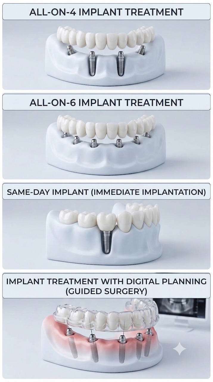 Implant7-EN https://akdisklinigi.com/wp-content/uploads/2026/09/Implant7-EN.jpeg